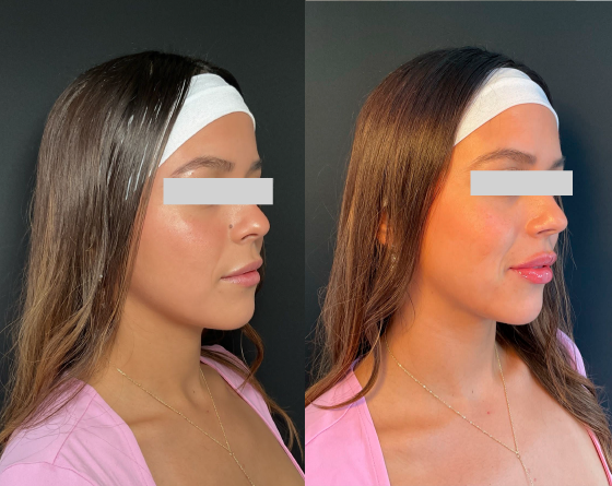 Enero 29 - Web foto (2)